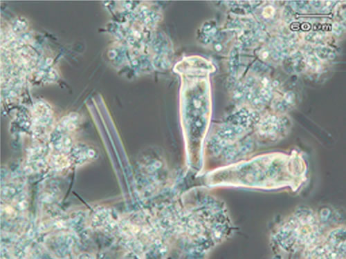 良好な水質状態の微生物